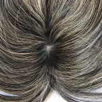 پروتز چهار کلیپس کف پوستی چتری-لایت - تصویر 6